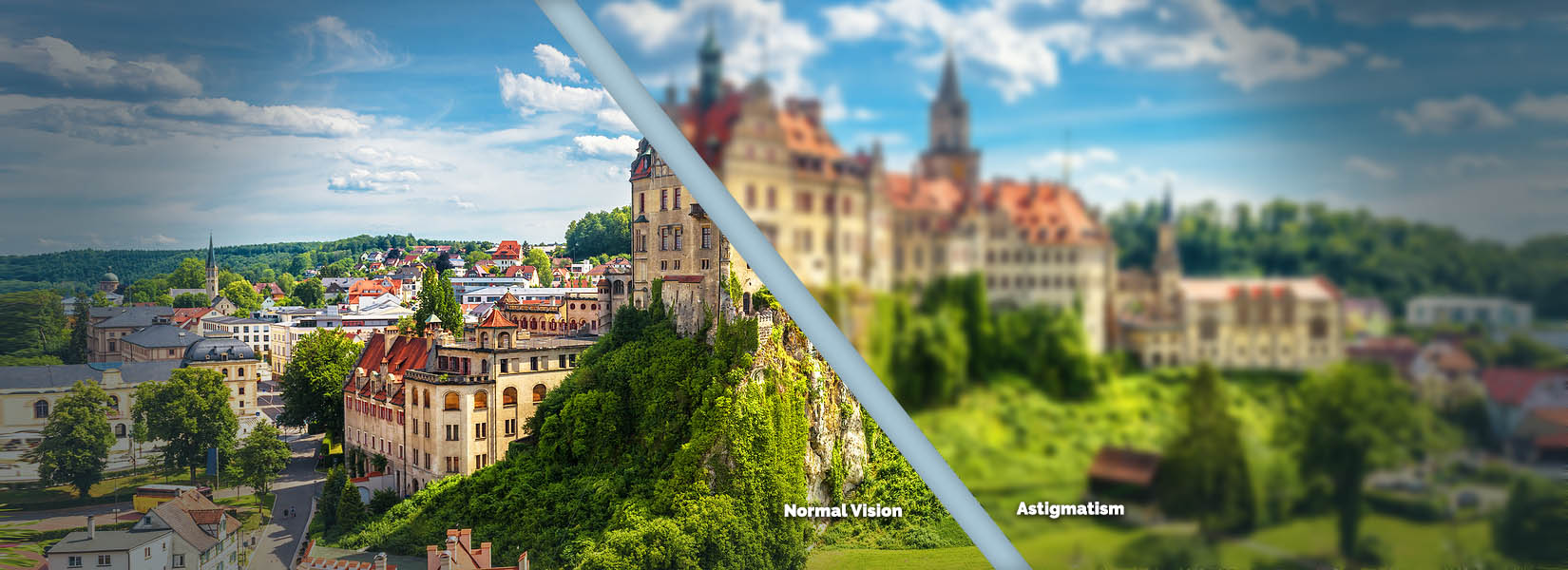 Astigmatism Treatment in Dover