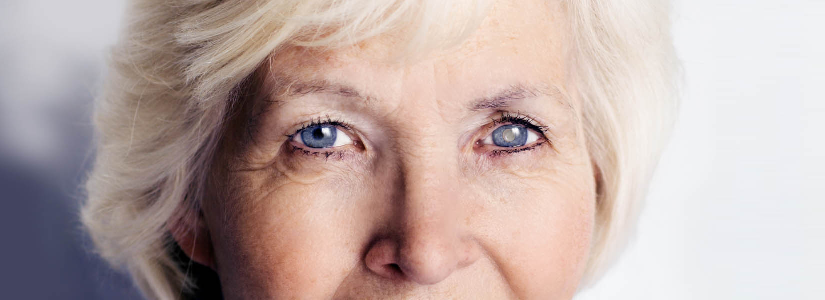 Cataract Surgery in Dover